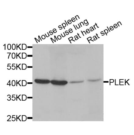 Anti-PLEK Antibody from Bioworld Technology (BS8116) - Antibodies.com