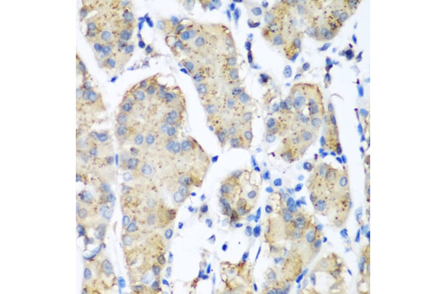Anti-PLEK Antibody from Bioworld Technology (BS8116) - Antibodies.com