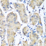 Anti-PLEK Antibody from Bioworld Technology (BS8116) - Antibodies.com