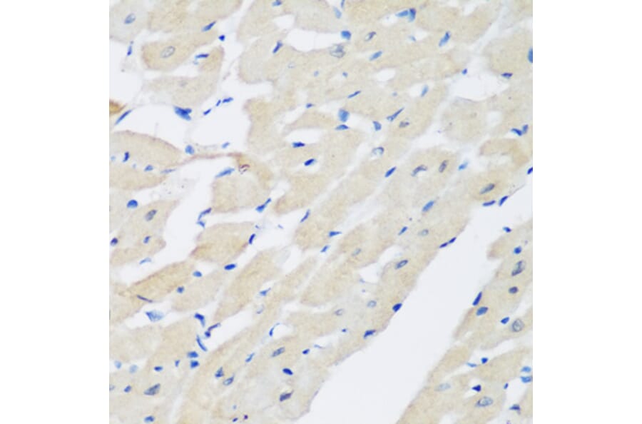 Anti-PLEK Antibody from Bioworld Technology (BS8116) - Antibodies.com