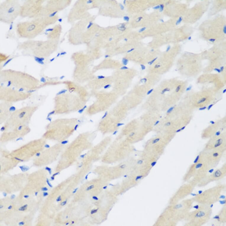 Anti-PLEK Antibody from Bioworld Technology (BS8116) - Antibodies.com