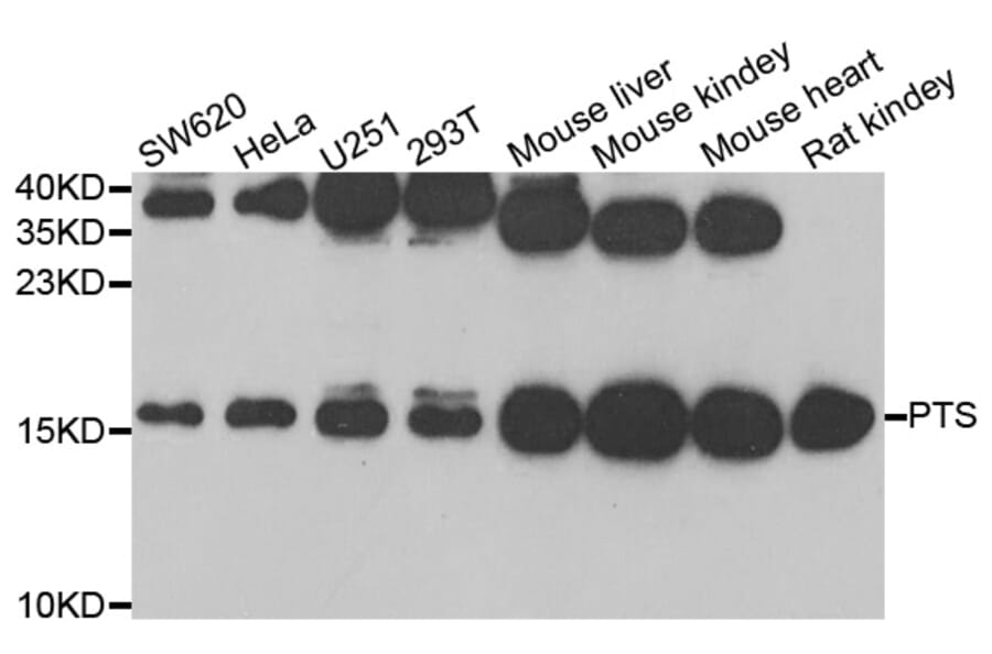 Anti-PTS Antibody from Bioworld Technology (BS8117) - Antibodies.com