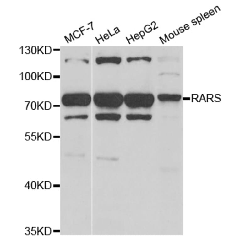 Anti-RARS Antibody from Bioworld Technology (BS8118) - Antibodies.com