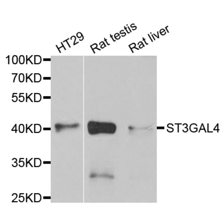 Anti-ST3GAL4 Antibody from Bioworld Technology (BS8119) - Antibodies.com