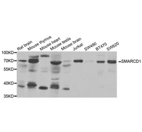 Anti-SMARCD1 Antibody from Bioworld Technology (BS8120) - Antibodies.com
