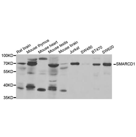 Anti-SMARCD1 Antibody from Bioworld Technology (BS8120) - Antibodies.com