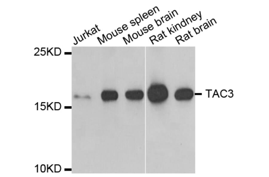 Anti-TAC3 Antibody from Bioworld Technology (BS8122) - Antibodies.com