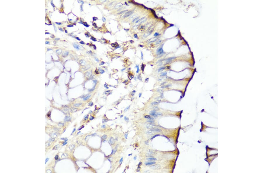 Anti-SERPINA7 Antibody from Bioworld Technology (BS8123) - Antibodies.com