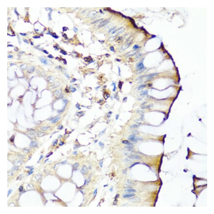 Anti-SERPINA7 Antibody from Bioworld Technology (BS8123) - Antibodies.com
