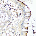 Anti-SERPINA7 Antibody from Bioworld Technology (BS8123) - Antibodies.com