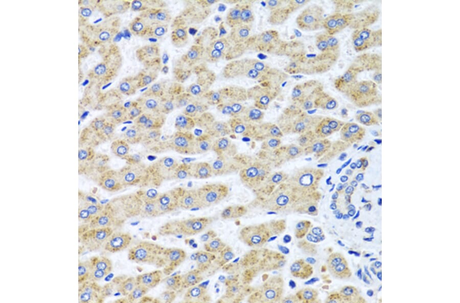 Anti-SERPINA7 Antibody from Bioworld Technology (BS8123) - Antibodies.com