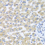 Anti-SERPINA7 Antibody from Bioworld Technology (BS8123) - Antibodies.com