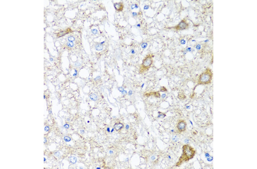 Anti-SERPINA7 Antibody from Bioworld Technology (BS8123) - Antibodies.com