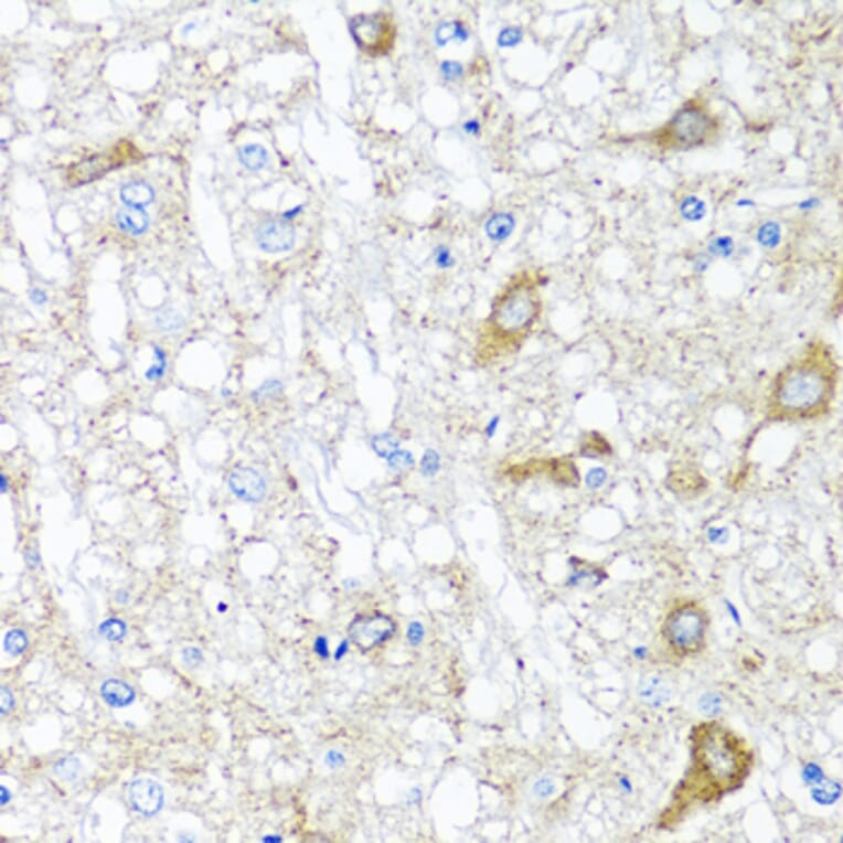 Anti-SERPINA7 Antibody from Bioworld Technology (BS8123) - Antibodies.com
