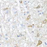 Anti-SERPINA7 Antibody from Bioworld Technology (BS8123) - Antibodies.com