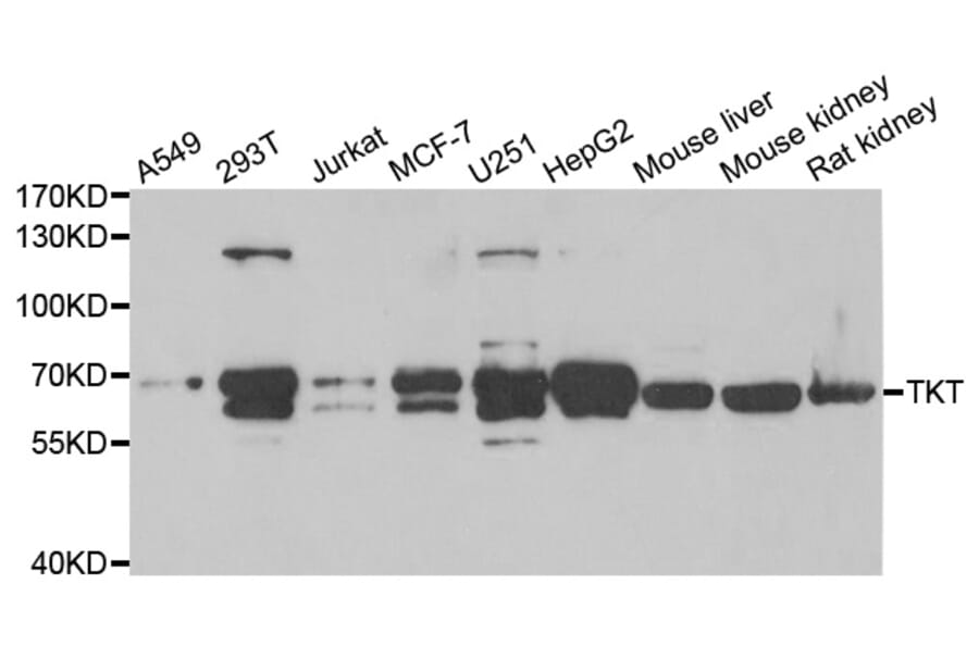 Anti-TKT Antibody from Bioworld Technology (BS8124) - Antibodies.com