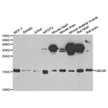 Anti-UBE2B Antibody from Bioworld Technology (BS8125) - Antibodies.com