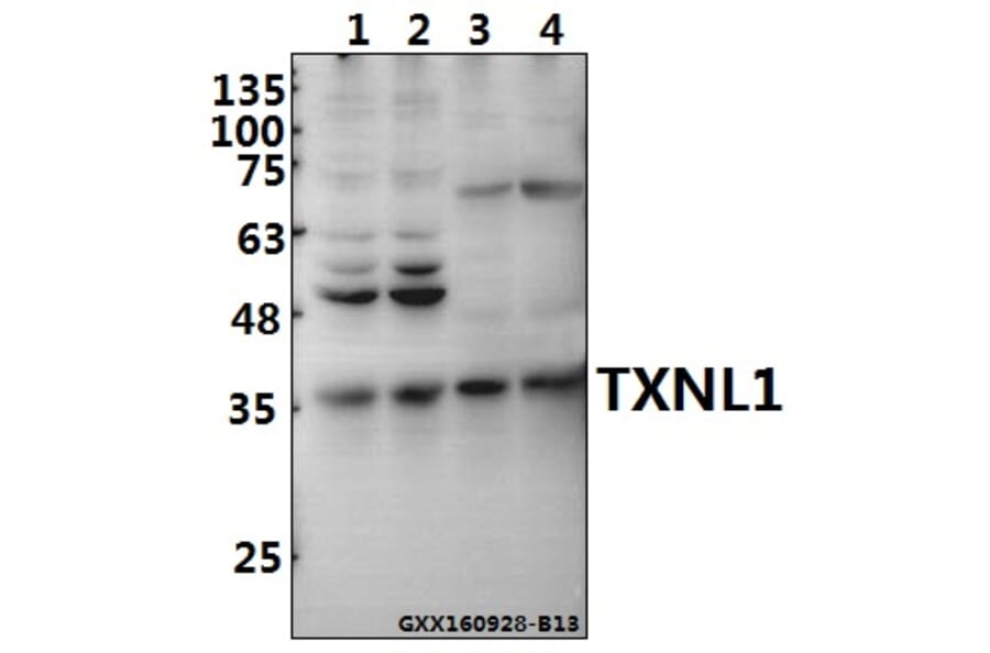 Anti-TXNL1 Antibody from Bioworld Technology (BS8129) - Antibodies.com