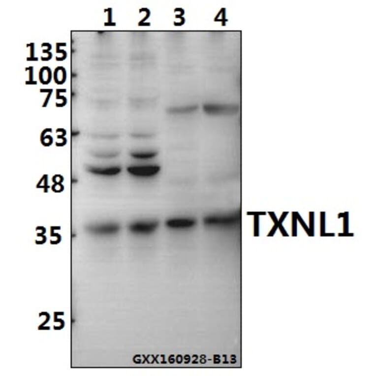 Anti-TXNL1 Antibody from Bioworld Technology (BS8129) - Antibodies.com