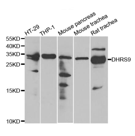 Anti-DHRS9 Antibody from Bioworld Technology (BS8131) - Antibodies.com