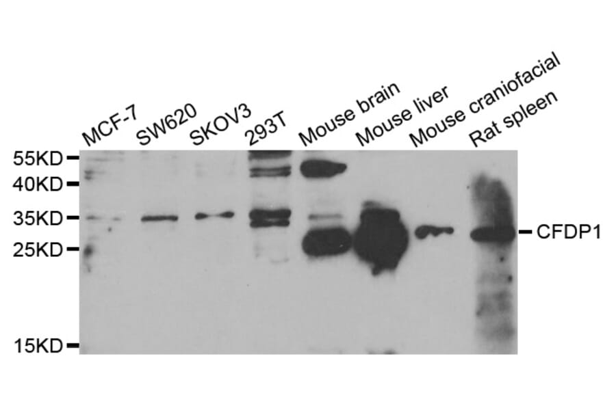 Anti-CFDP1 Antibody from Bioworld Technology (BS8132) - Antibodies.com