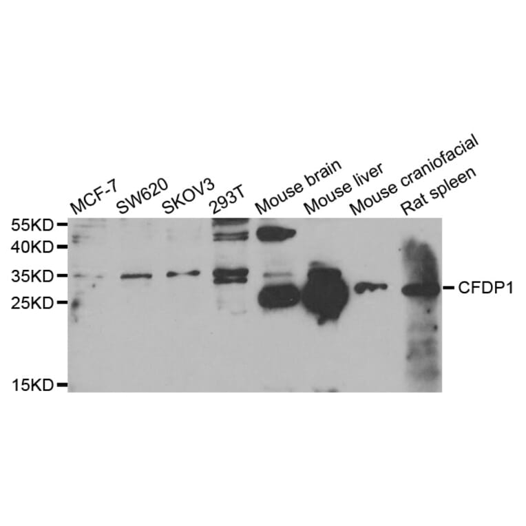 Anti-CFDP1 Antibody from Bioworld Technology (BS8132) - Antibodies.com