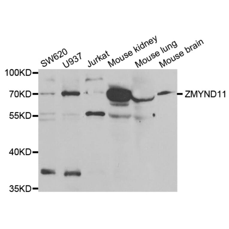 Anti-ZMYND11 Antibody from Bioworld Technology (BS8134) - Antibodies.com