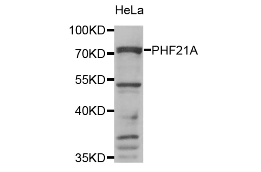 Anti-PHF21A Antibody from Bioworld Technology (BS8137) - Antibodies.com