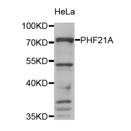 Anti-PHF21A Antibody from Bioworld Technology (BS8137) - Antibodies.com