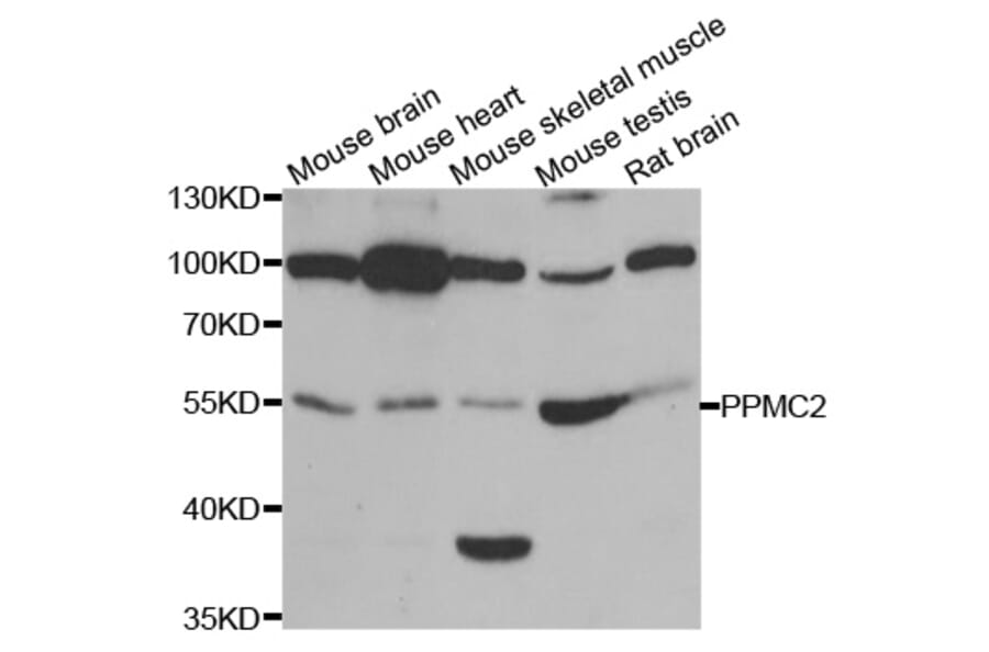 Anti-PPM2C Antibody from Bioworld Technology (BS8138) - Antibodies.com