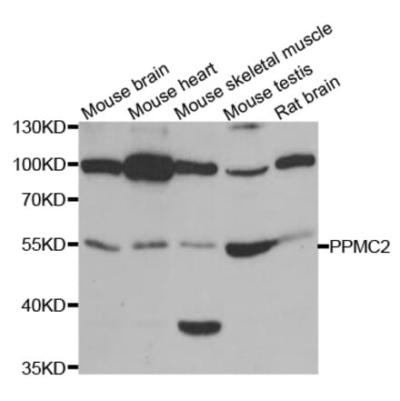 Anti-PPM2C Antibody from Bioworld Technology (BS8138) - Antibodies.com