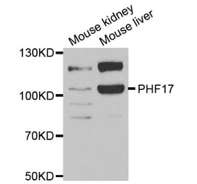 Anti-PHF17 Antibody from Bioworld Technology (BS8143) - Antibodies.com
