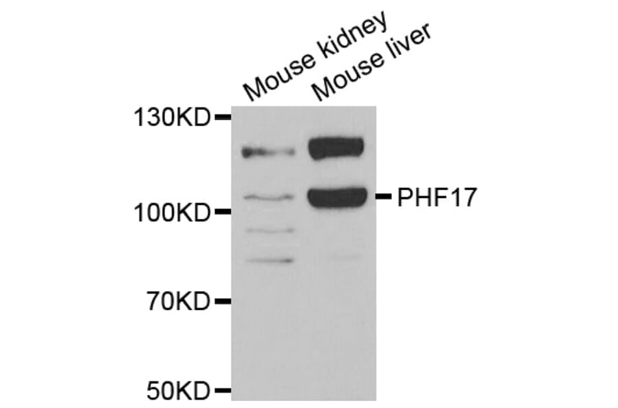 Anti-PHF17 Antibody from Bioworld Technology (BS8143) - Antibodies.com