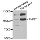 Anti-PHF17 Antibody from Bioworld Technology (BS8143) - Antibodies.com
