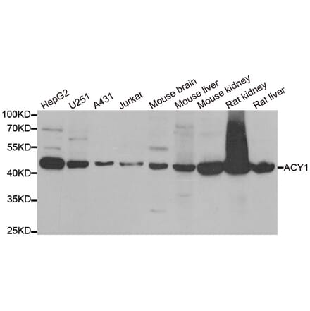 Anti-ACY1 Antibody from Bioworld Technology (BS8150) - Antibodies.com