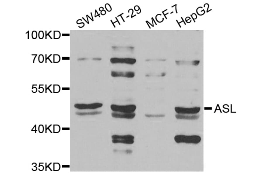Anti-ASL Antibody from Bioworld Technology (BS8154) - Antibodies.com