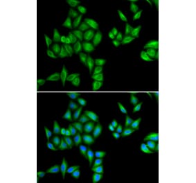 Anti-BTG1 Antibody from Bioworld Technology (BS8155) - Antibodies.com