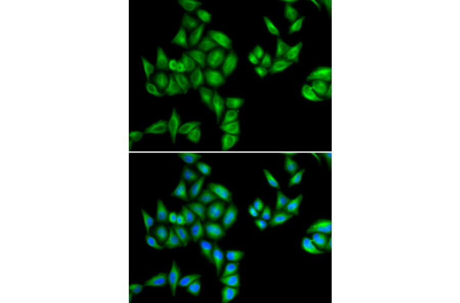 Anti-BTG1 Antibody from Bioworld Technology (BS8155) - Antibodies.com