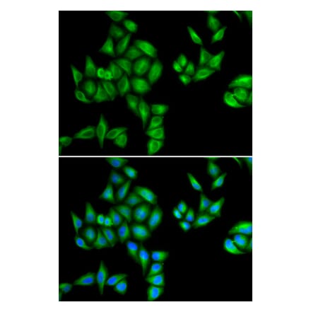 Anti-BTG1 Antibody from Bioworld Technology (BS8155) - Antibodies.com