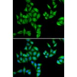 Anti-BTG1 Antibody from Bioworld Technology (BS8155) - Antibodies.com