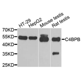 Anti-C4BPB Antibody from Bioworld Technology (BS8157) - Antibodies.com