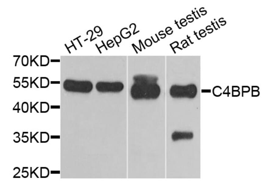 Anti-C4BPB Antibody from Bioworld Technology (BS8157) - Antibodies.com