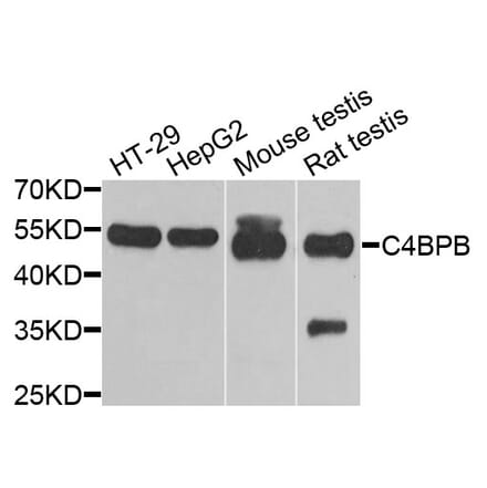 Anti-C4BPB Antibody from Bioworld Technology (BS8157) - Antibodies.com