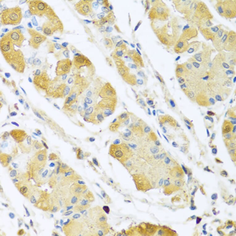 Anti-C4BPB Antibody from Bioworld Technology (BS8157) - Antibodies.com