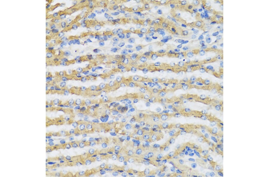 Anti-C4BPB Antibody from Bioworld Technology (BS8157) - Antibodies.com