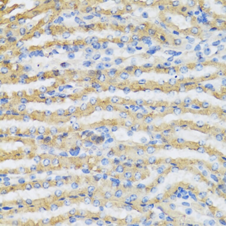 Anti-C4BPB Antibody from Bioworld Technology (BS8157) - Antibodies.com