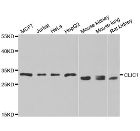 Anti-CLIC1 Antibody from Bioworld Technology (BS8158) - Antibodies.com