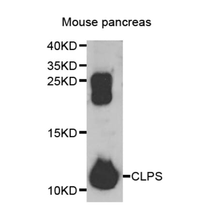 Anti-CLPS Antibody from Bioworld Technology (BS8159) - Antibodies.com