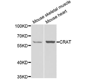 Anti-CRAT Antibody from Bioworld Technology (BS8160) - Antibodies.com