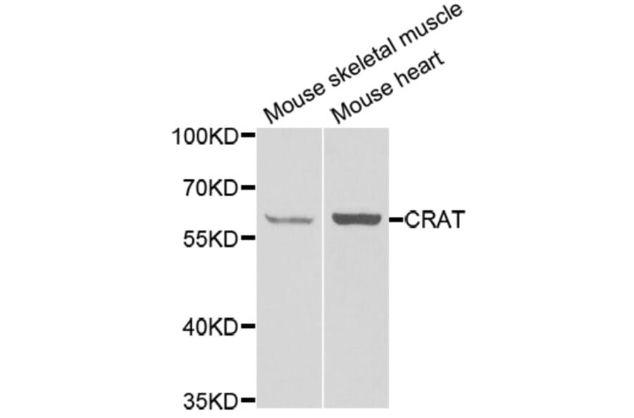 Anti-CRAT Antibody from Bioworld Technology (BS8160) - Antibodies.com